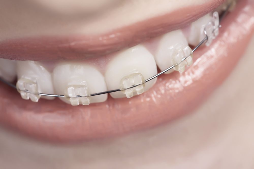 Izzah Multispeciality Dental Clinic & Orthodontic Centre