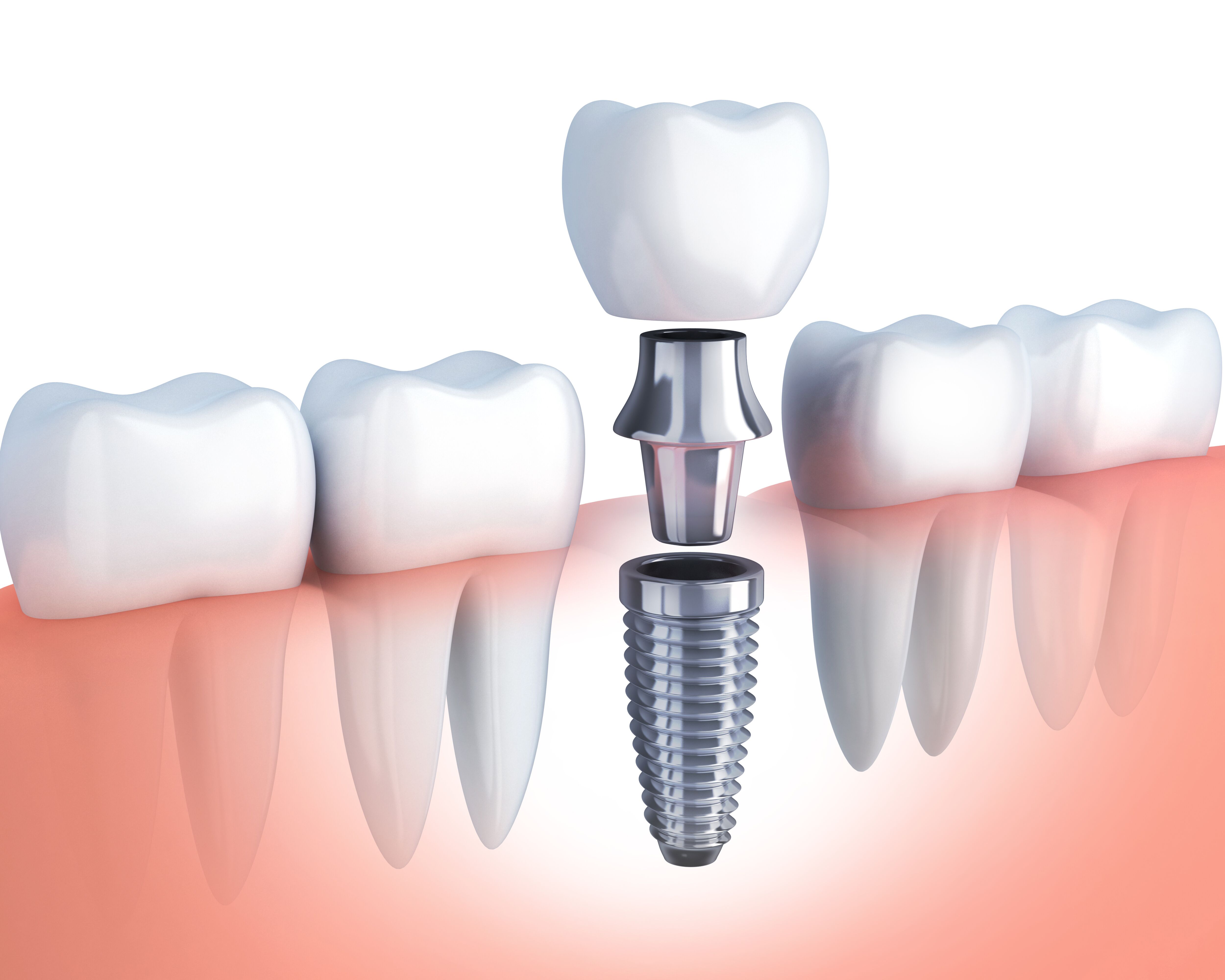 Izzah Multispeciality Dental Clinic & Orthodontic Centre