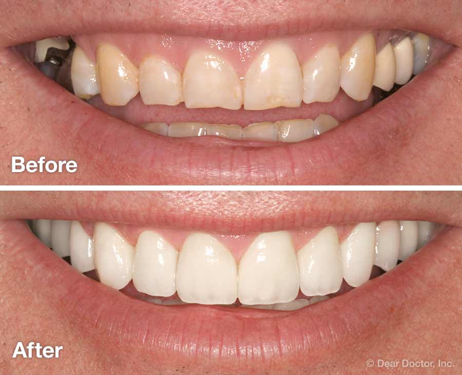 Izzah Multispeciality Dental Clinic & Orthodontic Centre
