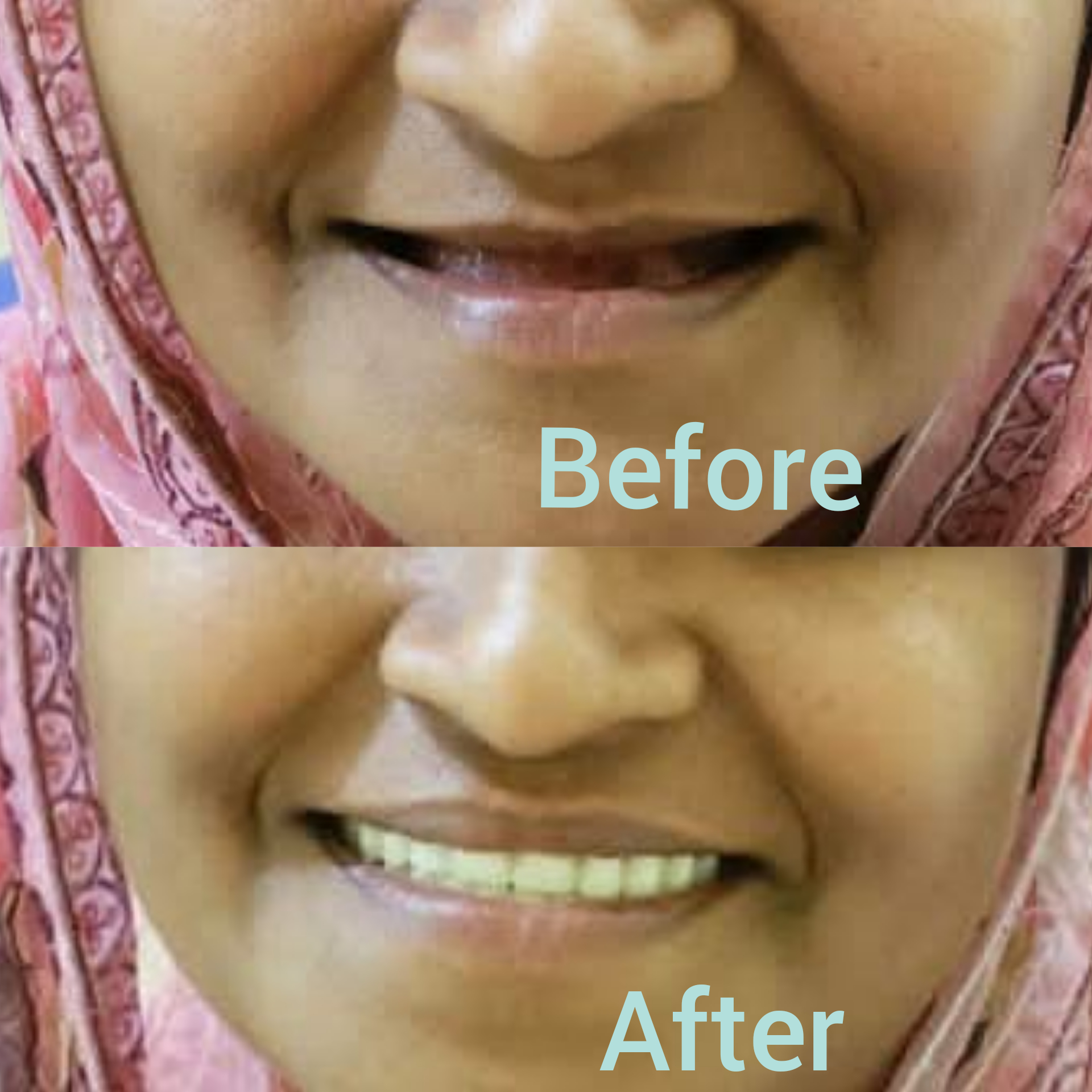 Izzah Multispeciality Dental Clinic & Orthodontic Centre