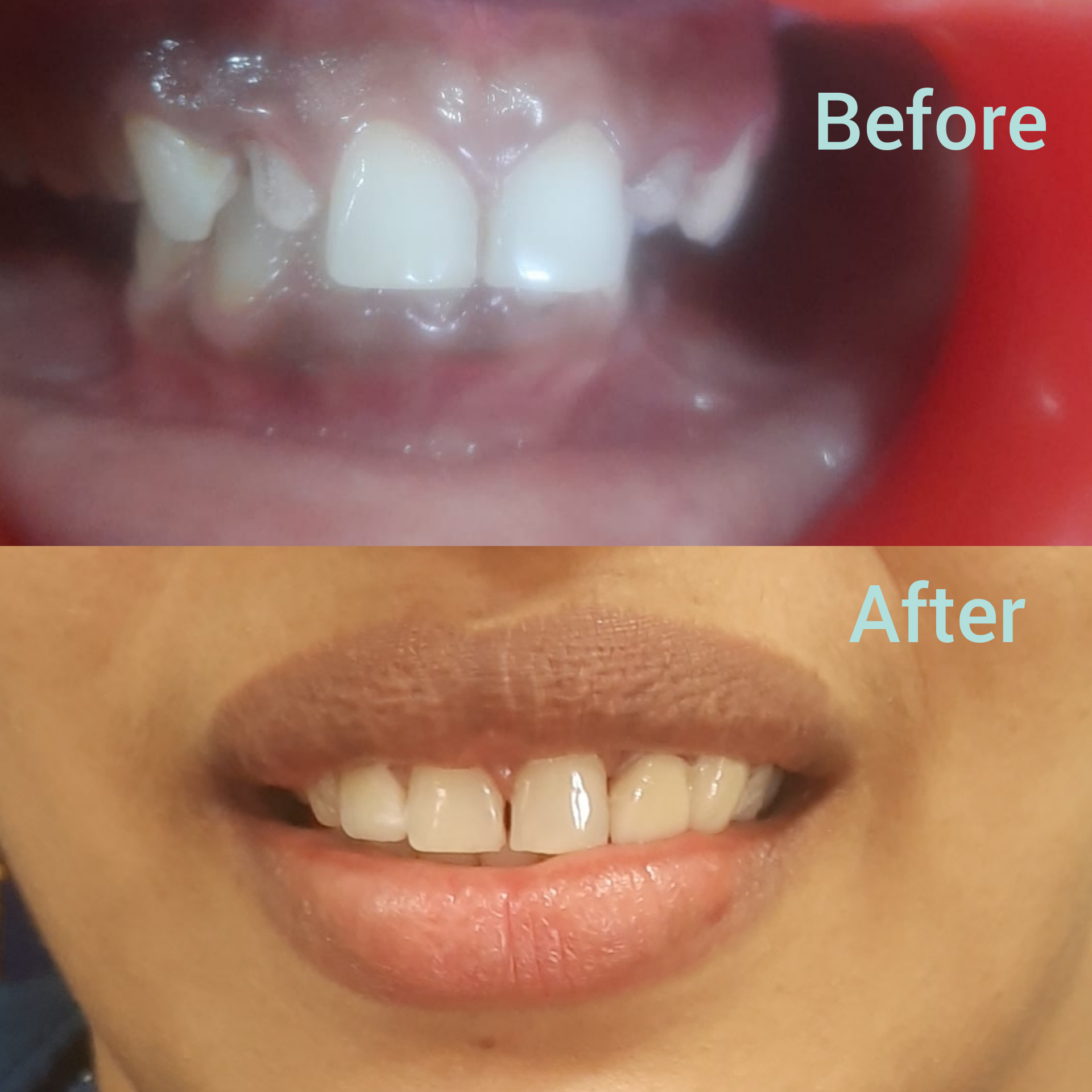 Izzah Multispeciality Dental Clinic & Orthodontic Centre