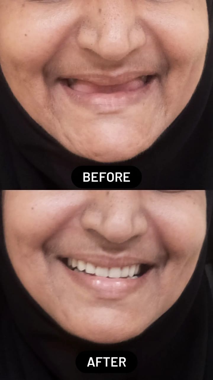 Izzah Multispeciality Dental Clinic & Orthodontic Centre