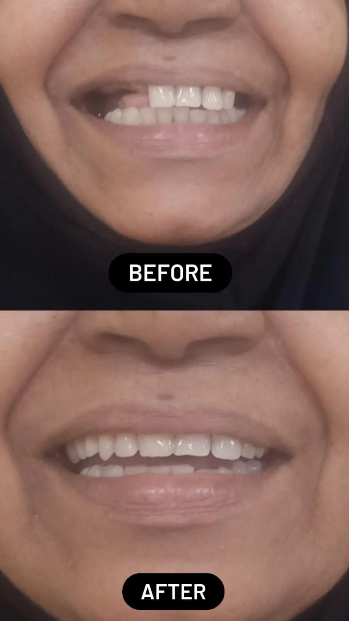 Izzah Multispeciality Dental Clinic & Orthodontic Centre